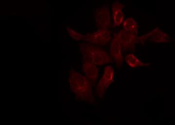 SYNE3 / C14orf49 Antibody
