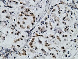 EPM2AIP1 Antibody (clone OTI2G3)