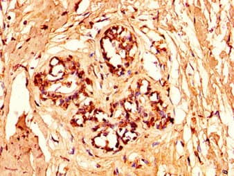 HIST1H1C Antibody