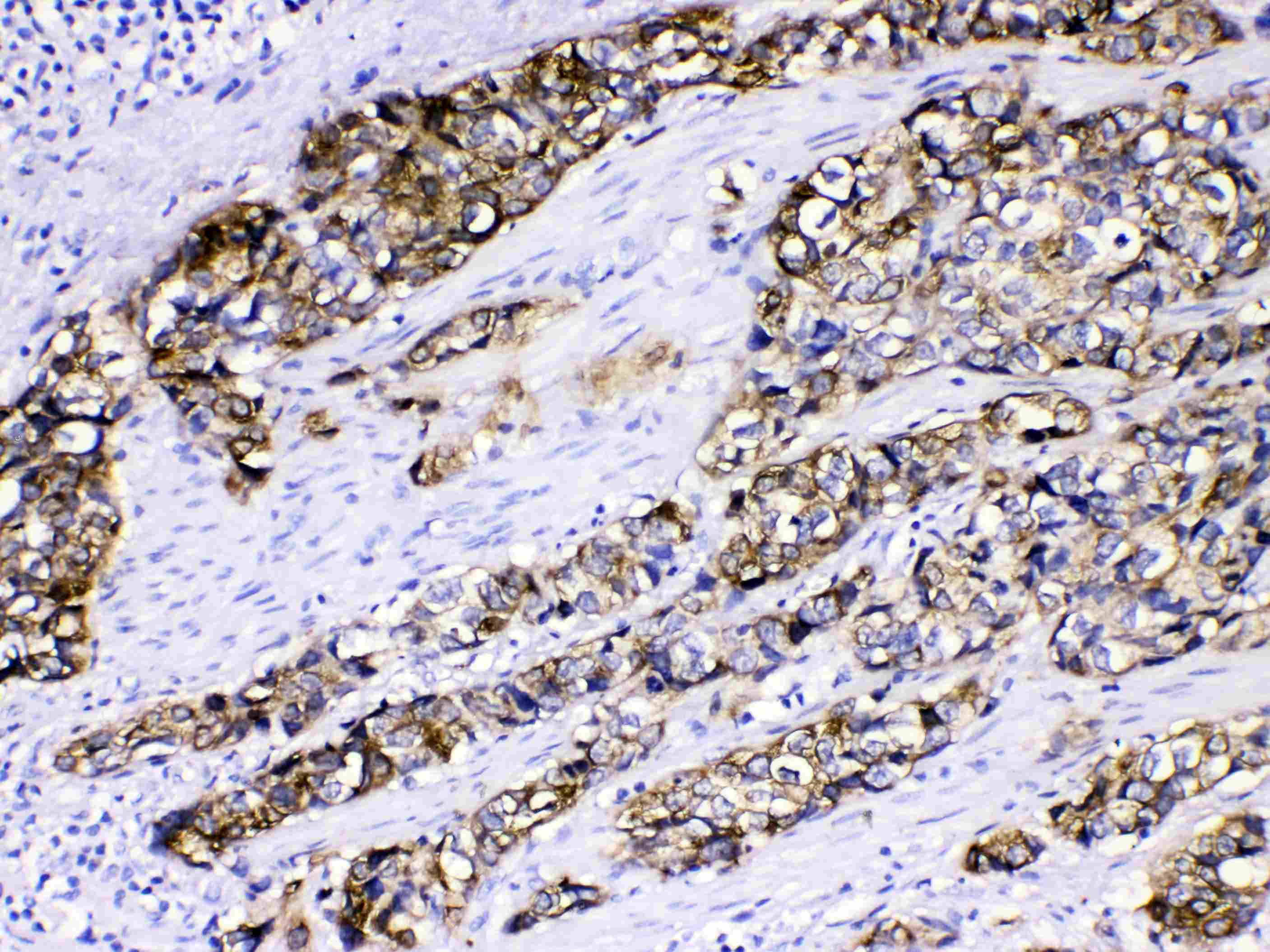 KRT5 / CK5 / Cytokeratin 5 Antibody
