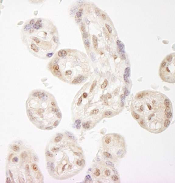 NELFA / WHSC2 Antibody (aa499-549)