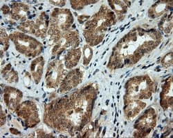 LIPG / Endothelial Lipase Antibody (clone OTI8F8)
