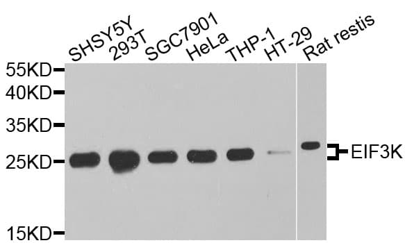 Polyclonal Rabbit anti-Human EIF3K Antibody (WB)