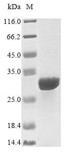 Human IL15RA Protein (Recombinant 10His, N-terminus + Myc, C-terminus)