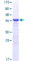 Human MBD5 Protein (Recombinant GST)