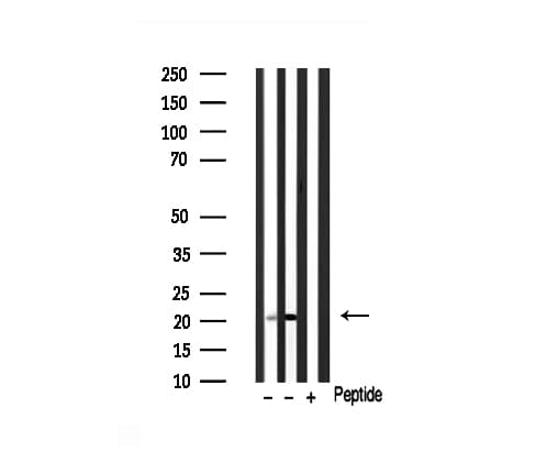 Polyclonal Rabbit anti-Human CIB2 / KIP2 Antibody (IHC, IF, WB)