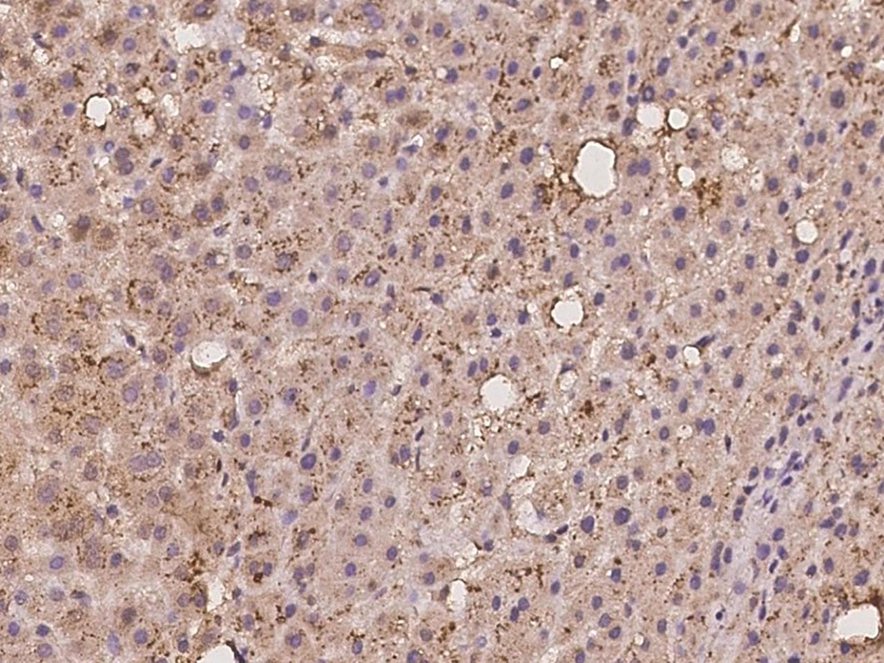 Polyclonal Rabbit anti-Human MRPL42 / MRPS32 Antibody (IHC)