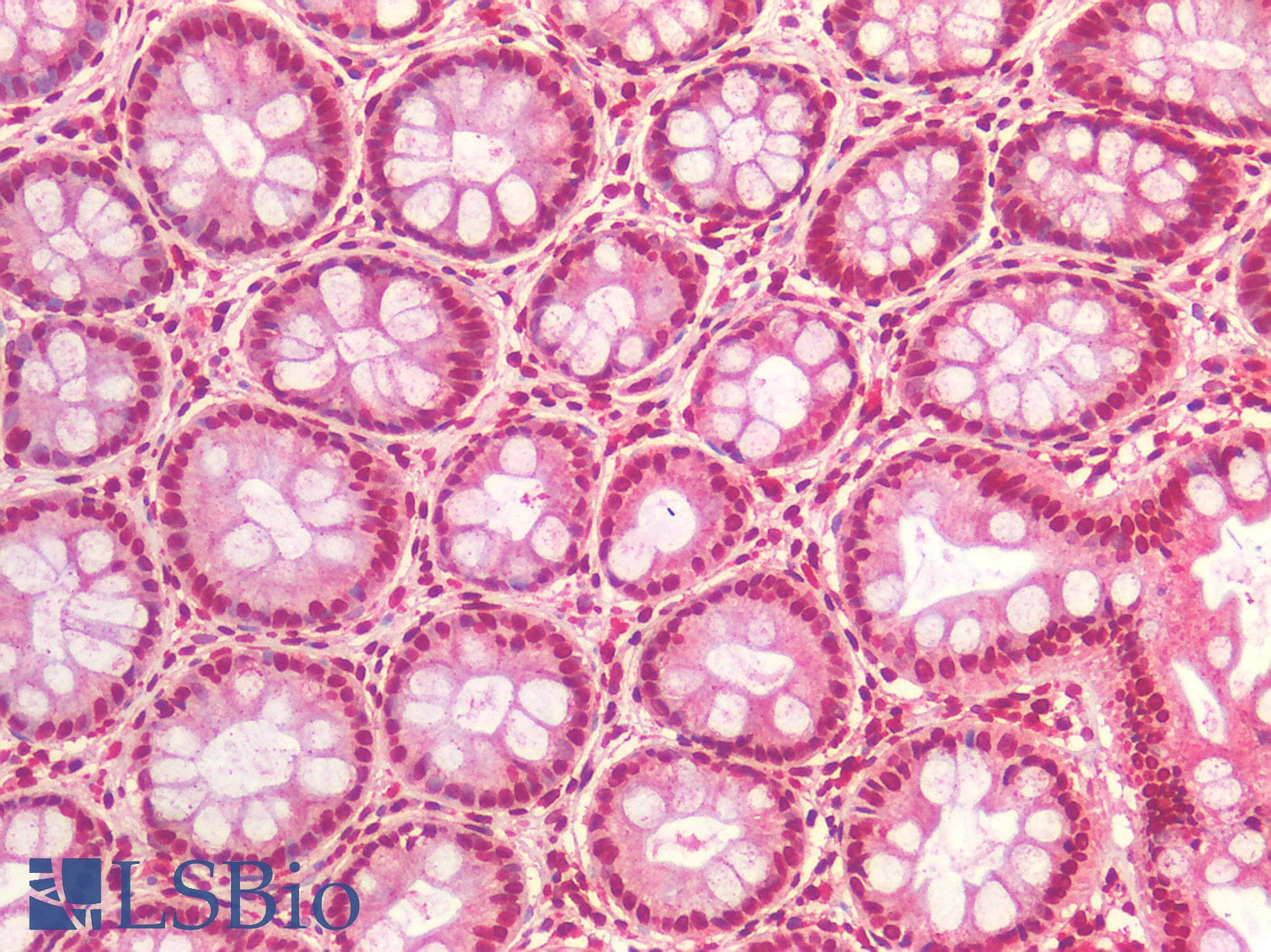 IHC-plus™ Polyclonal Rabbit anti-Human IGF1R / IGF1 Receptor Antibody (IHC)
