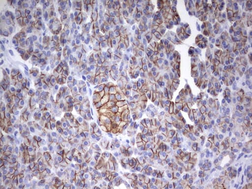 EPCAM Antibody (clone UMAB132)