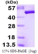 Human ENO3 / Enolase 3 Protein (Recombinant His)