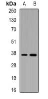 CD1A Antibody