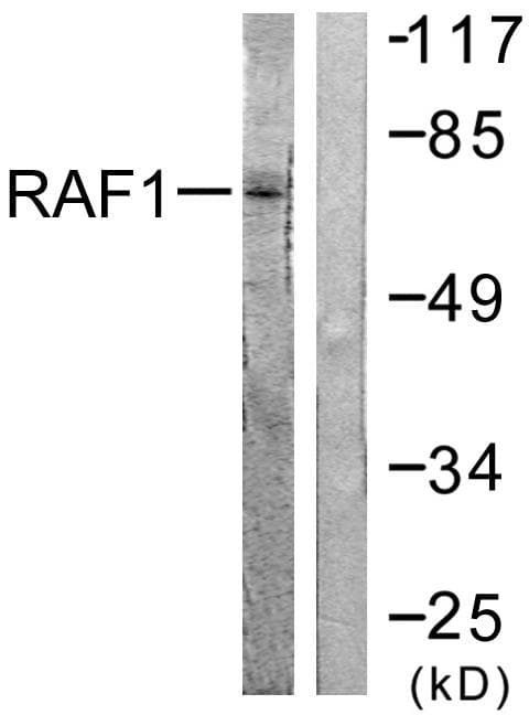 RAF1 / RAF Antibody (p621)
