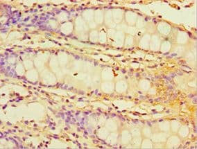 YKL39 / CHI3L2 Antibody (aa27-390)