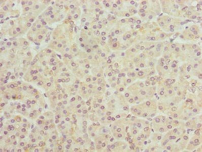 TMEM205 Antibody