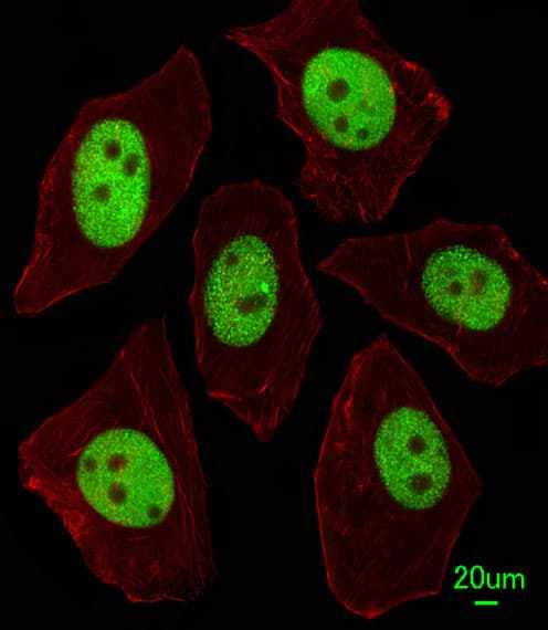 IHC-plus™ Polyclonal Rabbit anti-Human LIN28A / LIN28 Antibody (aa108-138, IHC, IF, WB)