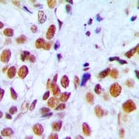 Polyclonal Rabbit anti-Human RAD54L Antibody (Internal, IHC, IF, WB)