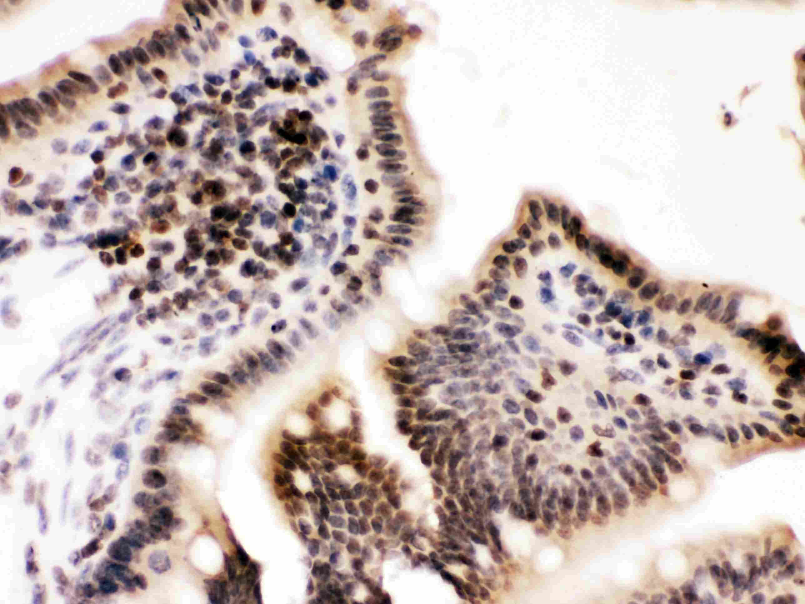 CCNT1 / Cyclin T1 Antibody