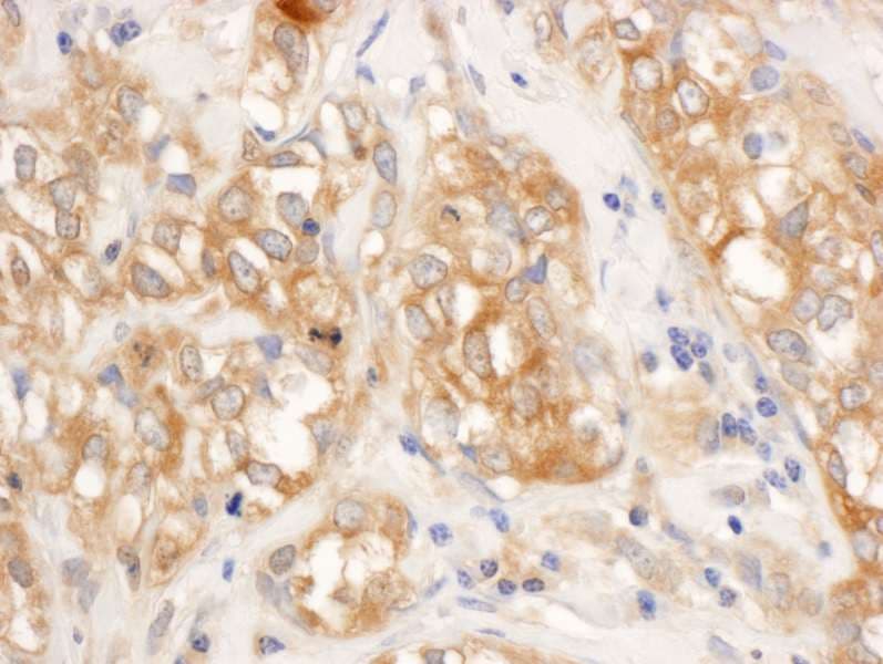 RELA / NFKB p65 Antibody (aa501-551)