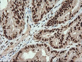 TRMT2A Antibody (clone OTI3D8, Carrier-free)
