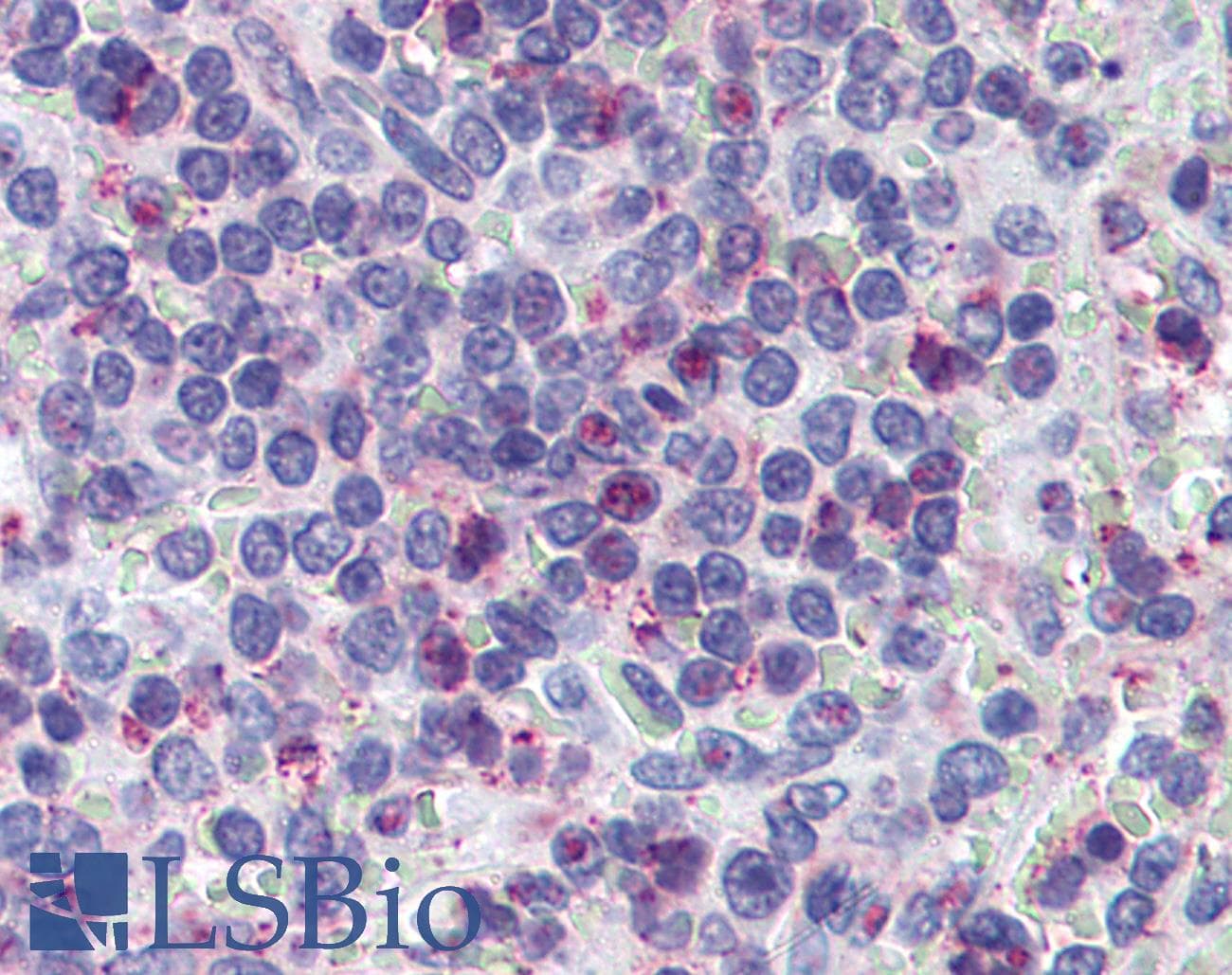 IHC-plus™ Leukotriene B4 Receptor / BLT1 Antibody (Cytoplasmic Domain)