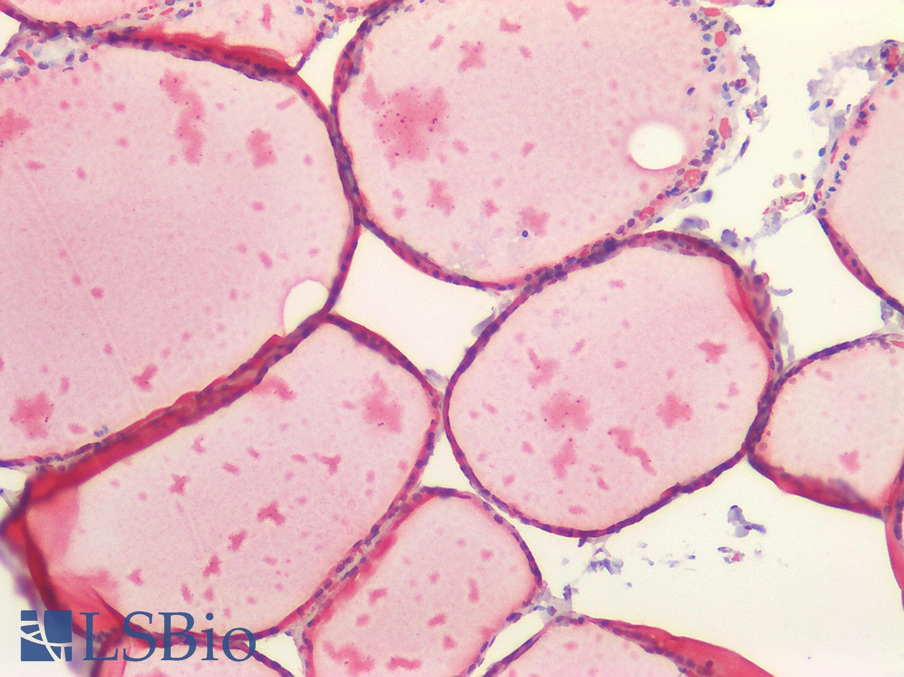 IHC-plus™ STUB1 / CHIP Antibody