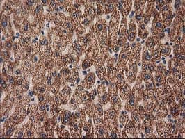 MMAB Antibody (clone OTI2G5, Carrier-free)