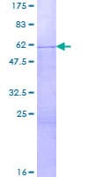 Human SURF1 Protein (Recombinant GST)
