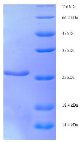 Human XRCC5 / Ku80 Protein (Recombinant His)
