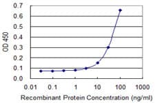 IHC-plus™ Monoclonal Mouse anti-Human PPP2R1A Antibody (clone 4E6, IHC, WB)