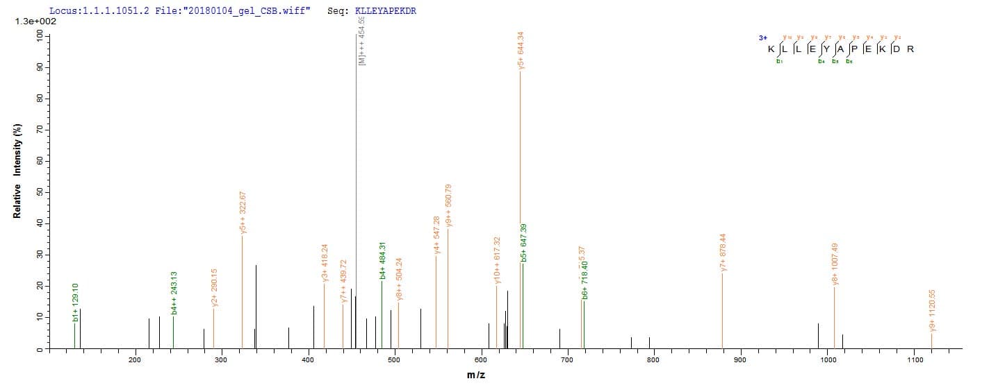 Aggregatibacter actinomycetemcomitans lktA Protein (Recombinant 6His, N-terminus)