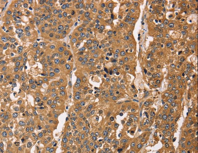 CAPZA3 Antibody