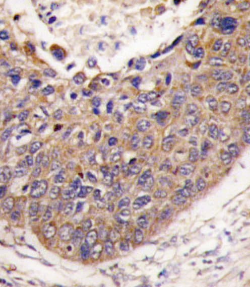 Polyclonal Rabbit anti-Human FXN / Frataxin Antibody (aa143-172, IHC, WB)