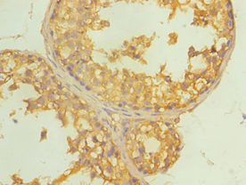 P5CDH / ALDH4A1 Antibody (aa354-563)