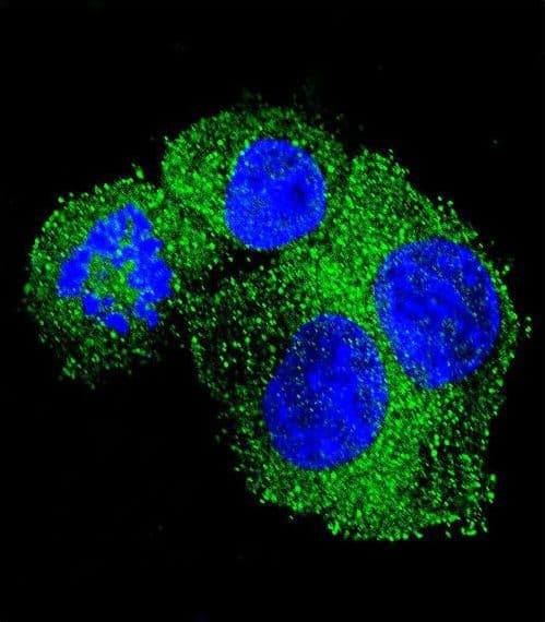 APP / Beta Amyloid Precursor Antibody (aa333-362)