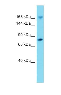Polyclonal Rabbit anti-Mouse IQGAP2 Antibody (aa1451-1500, WB)