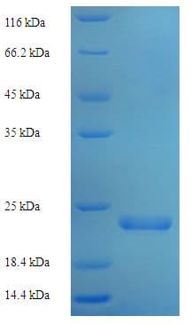Rat Reg3b Protein (Recombinant His)