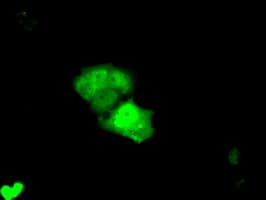 KHK / Ketohexokinase Antibody (clone OTI4H3)