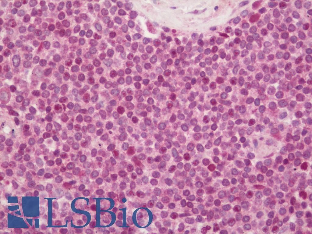 IHC-plus™ SETD2 Antibody