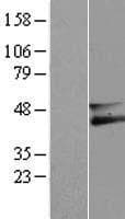 TMEM259 / Membralin Protein (Over-Expression Lysate Myc-DDK (Flag))