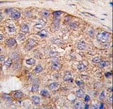 Polyclonal Rabbit anti-Human UBTD1 Antibody (aa180-212, IHC, WB)