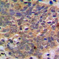 Polyclonal Rabbit anti-Human AKT1 + AKT2 + AKT3 Antibody (phospho-Ser473, IHC, WB)