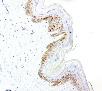 Monoclonal Mouse anti-Human VILIP / VSNL1 Antibody (clone UMAB115, aa2-191, IHC, IF, WB)