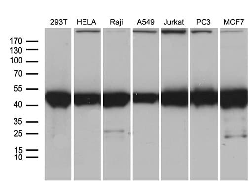 BAG5 Antibody (clone OTI2C7)