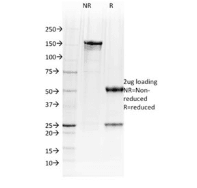 POU2AF1 / BOB1 Antibody (clone BOB1/2423)