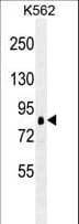 RPS6KA1 / RSK1 Antibody