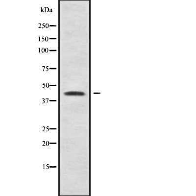 B4GALT2 Antibody