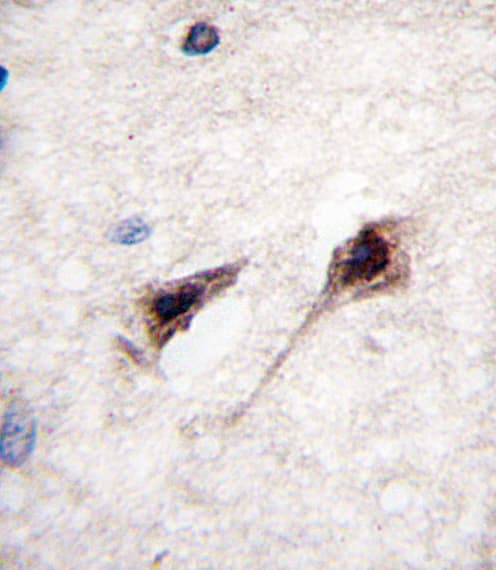 MEF2C Antibody (Ser387)