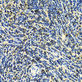 Polyclonal Rabbit anti-Human CD3E Antibody (IHC, IF, WB)