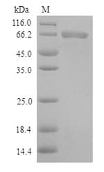 Human TLR1 Protein (Recombinant 6His, N-terminus)