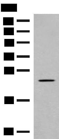 Polyclonal Rabbit anti-Human CLEC3B / Tetranectin Antibody (IHC, WB)
